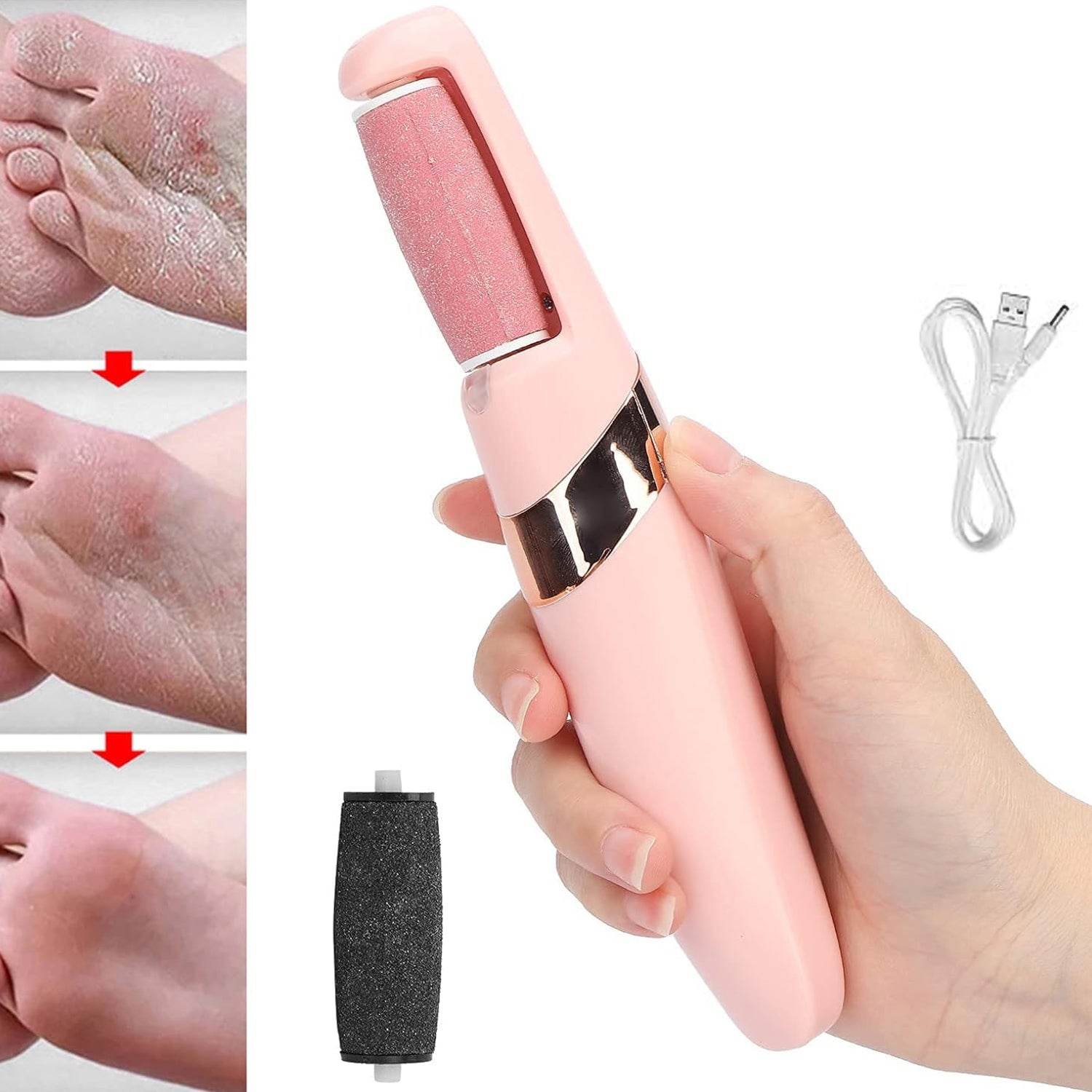Flewless Pedi Electronic Pedicure Tool (1 Set) - 9XShoppy