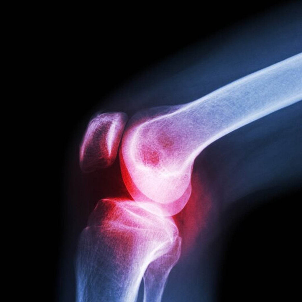 6233 (Xl) Knee Cap For Knee Support - 9XShoppy